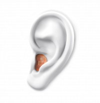 IN THE EAR (ITE))